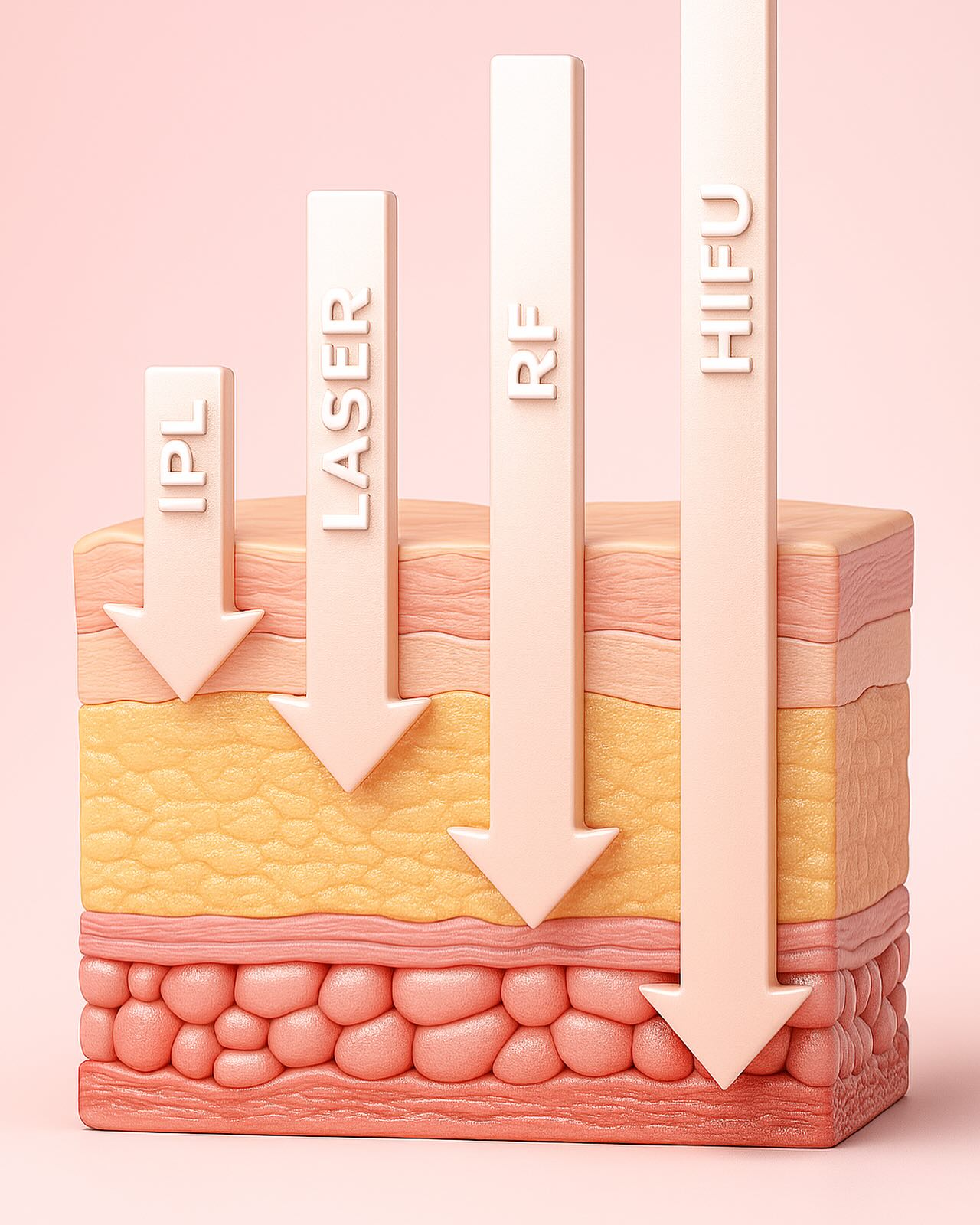 ✨ GO DEEPER WITH HIFU!
As the image shows clearly, not all skin treatments reach the same depth:
🔹 IPL and LASER only target the surface.
🔹 RF (Radiofrequency) goes a bit deeper.
✅ But only HIFU, reaches the SMAS layer, the same layer targeted in surgical facelifts.
🔬 Backed by science, driven by results, HIFU uses focused ultrasound to deliver thermal energy deep within the skin, stimulating collagen and elastin like no other non-invasive treatment.
🌟 What HIFU can do for you:
✔️ Natural, long-lasting lifting effect
✔️ Tightens sagging skin
✔️ Redefines facial contours
✔️ Boosts deep collagen production
✔️ No downtime, no needles, no surgery
Experience the most advanced, science-based skin tightening technology available in Melbourne.
Your skin deserves the deepest and safest care.
Book your session today with HIFU 4 You Skin Lab!
.
.
.
.
.
#MPTHiFu #HiFuForYouSkinLab #HiFuMelbourne #SkinLifting #SkinTightening #FacialLifting #NonSurgicalFacelift #AdvancedAesthetics #MedicalSkinClinic #SkinClinicMelbourne #CollagenBoost #YouthfulSkin #DermalTherapist #RejuvenationTreatment #SkinFirming #RFvsHIFU #LaserVsHIFU #AntiAgingTreatment #AestheticTechnology #BeautyScience